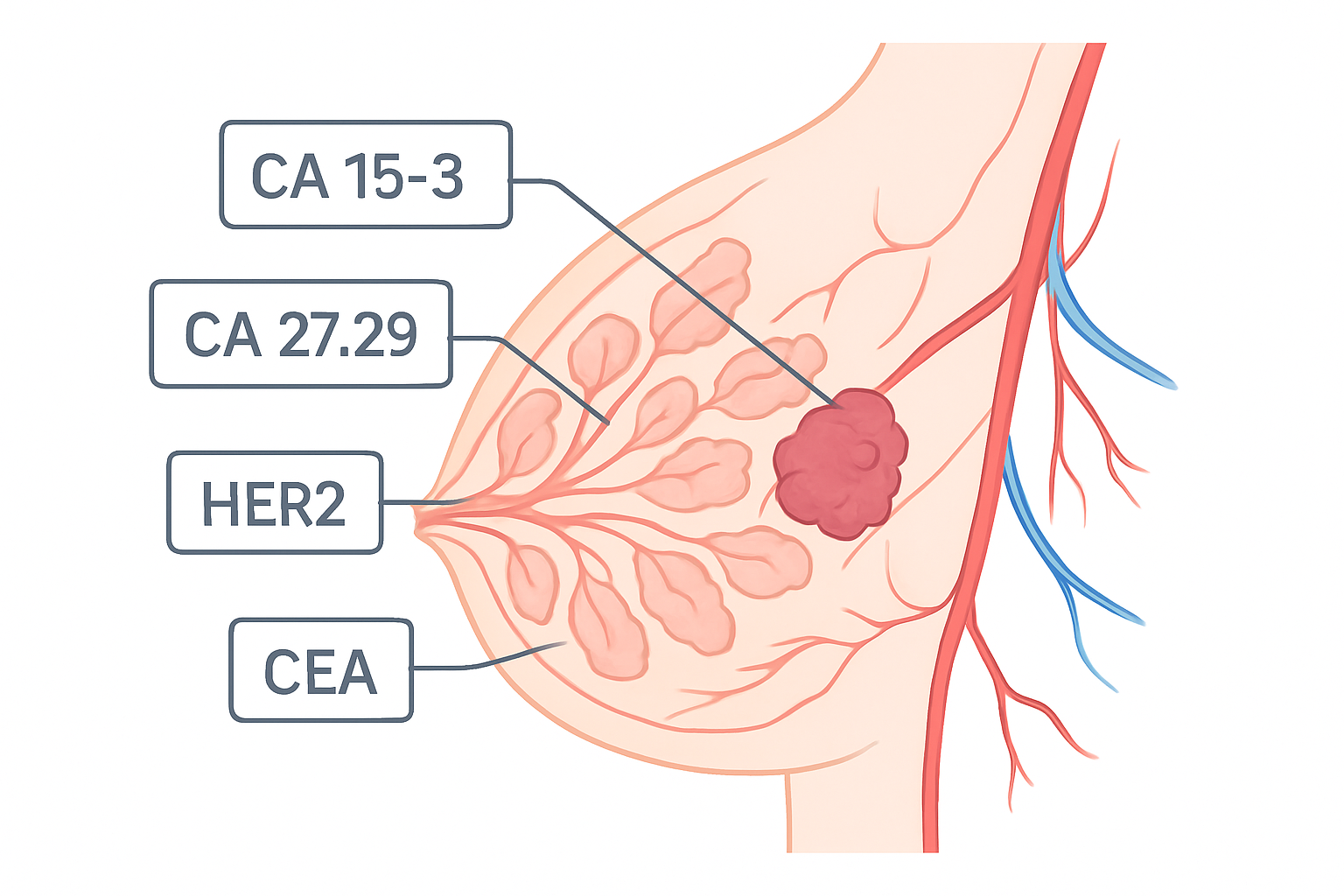 Understanding Tumor Markers: What They Mean for Breast Cancer